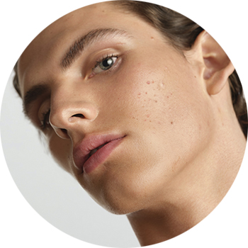 Combination, oily to acne-prone skin