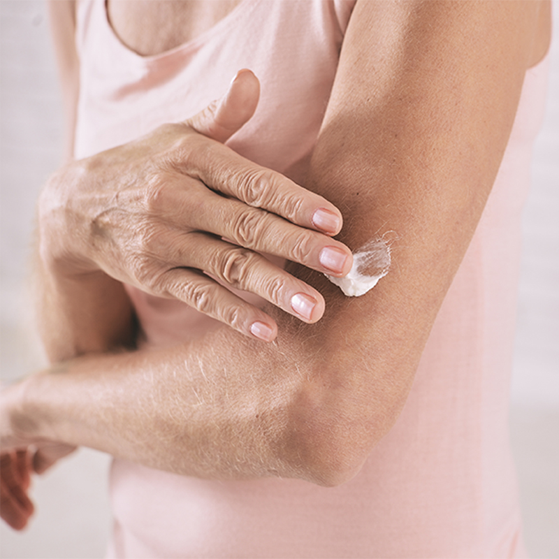 woman scraching her arm