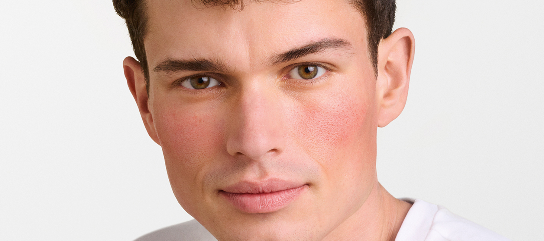 Man with visible facial redness on his cheeks​