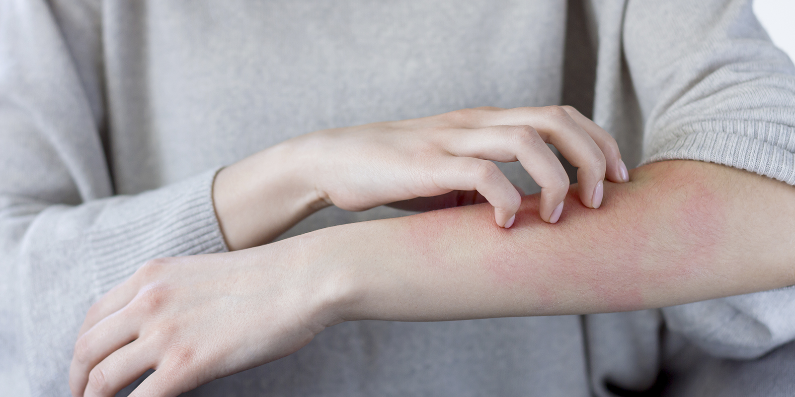 woman scraching her arm